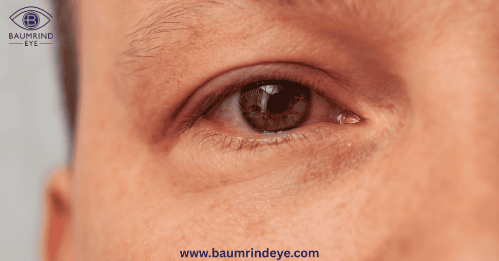 Common Symptoms and Triggers