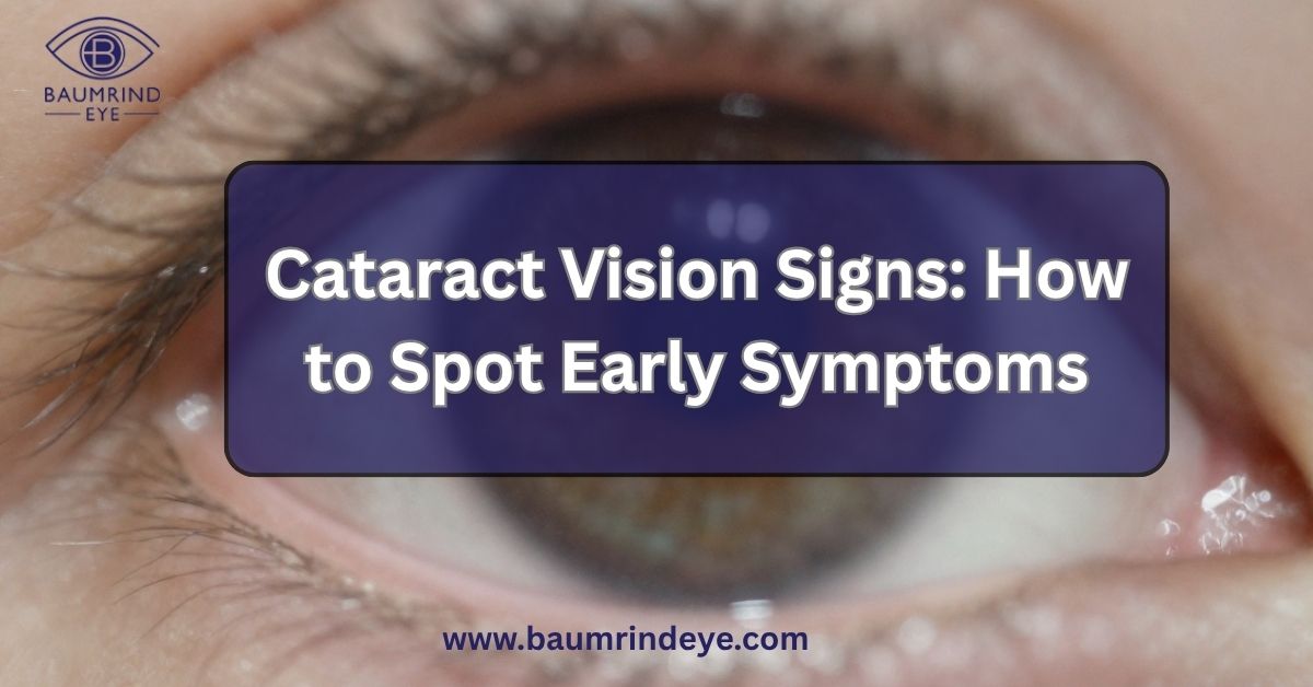 Cataract Vision Signs: How to Spot Early Symptoms - Baumrindeye